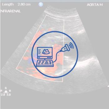 Abdominal Duplex Sonography