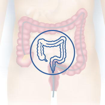 Diagnostic and Therapeutic Lower Endoscopy