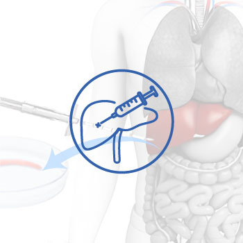 Percutaneous Liver Biopsy